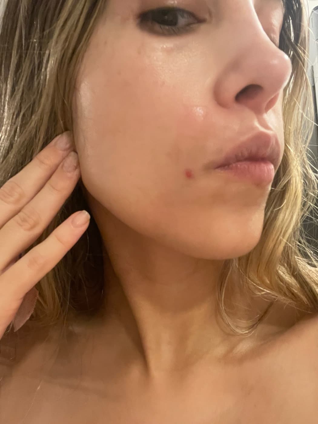 Melissa today, one small spot by her lip, side view